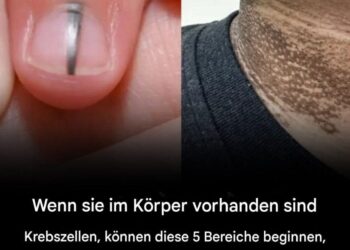 Wenn im Körper Krebszellen vorhanden sind, können diese 5 Bereiche beginnen, sich ungewöhnlich dunkel zu verfärben.