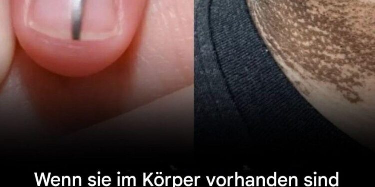Wenn im Körper Krebszellen vorhanden sind, können diese 5 Bereiche beginnen, sich ungewöhnlich dunkel zu verfärben.