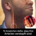 10 Anzeichen, um verstopfte Arterien zu erkennen
