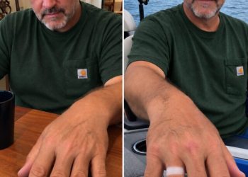 Nach seinem Angelausflug bemerkte ich eine frische Ringabdruckstelle am Finger meines Mannes, dann machte seine Erklärung alles noch schlimmer