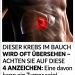 LEBERKREBS HAT SEHR ERKENNBARE SYMPTOME – SIE DÜRFEN SIE NICHT ÜBERSEHEN: Das sind die 4 Entwicklungsstadien dieses tückischen Tumors!